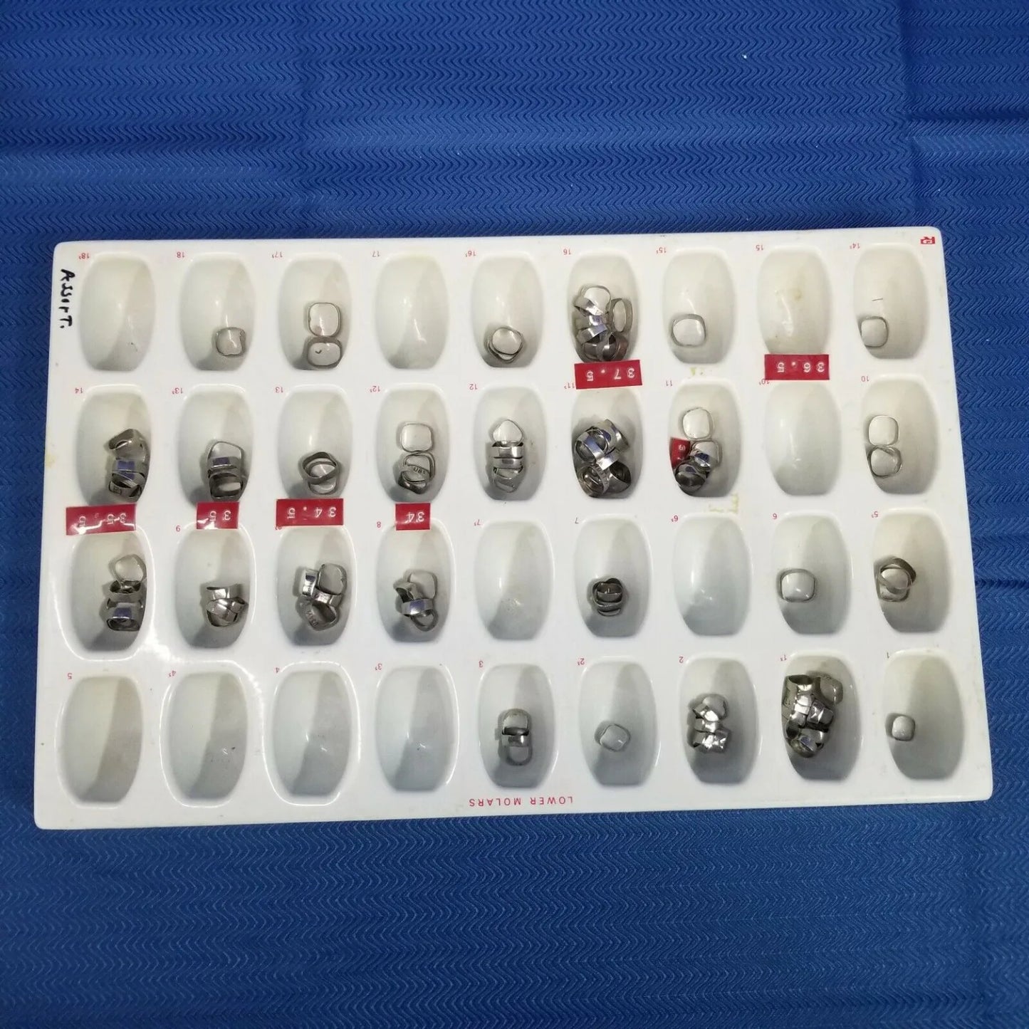 Plain Steel Posterior Dental Bands – 110 Pieces - Dental Parts Shop